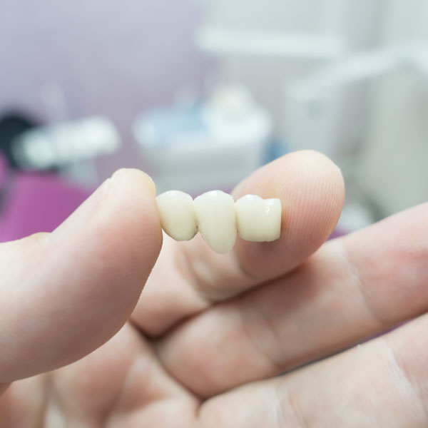 man holding dental bridge